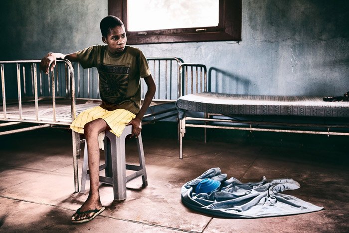 Photojournalism portrait of a boy whose leg had to be amputated.