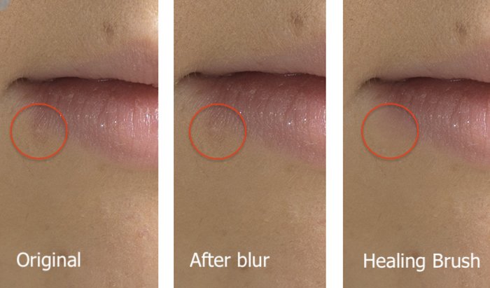 Triptych comparison of two methods of retouching blemishes in Photoshop